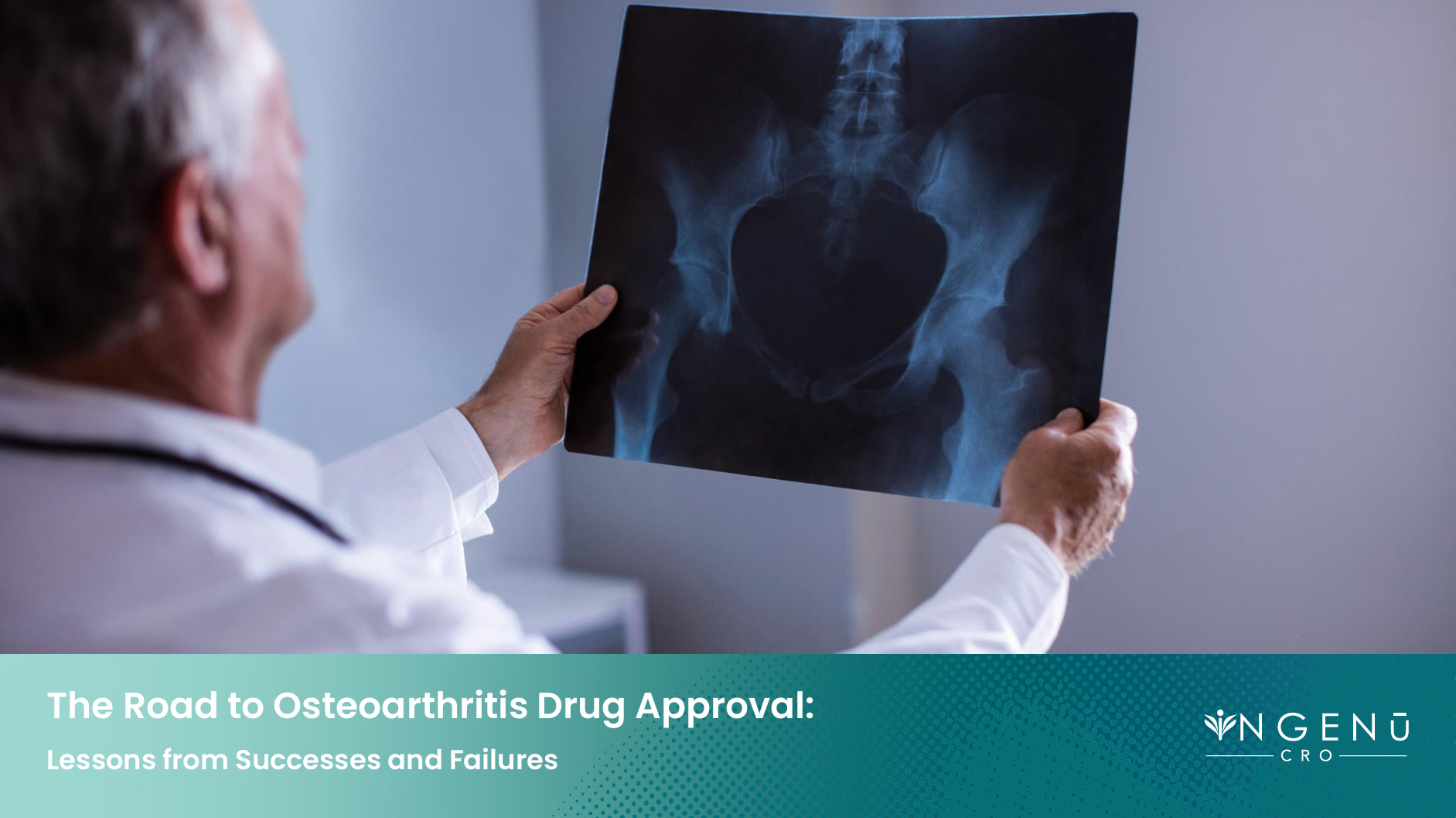 The Road to Osteoarthritis Drug Approval
