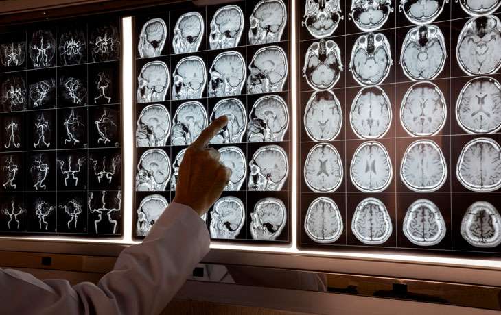 ingenu-clinical-specialties-neuroscience