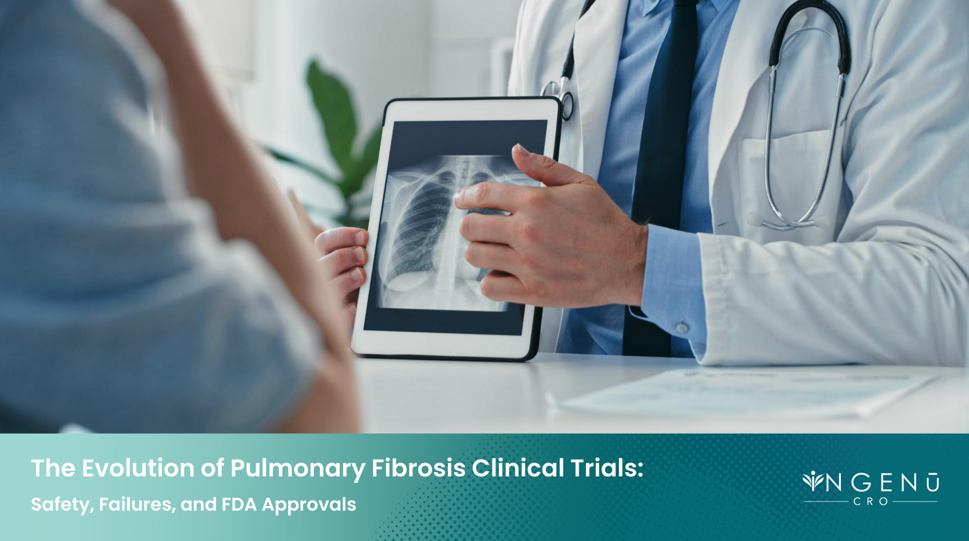 The Evolution of Pulmonary Fibrosis Clinical Trials The Evolution of Pulmonary Fibrosis Clinical Trials